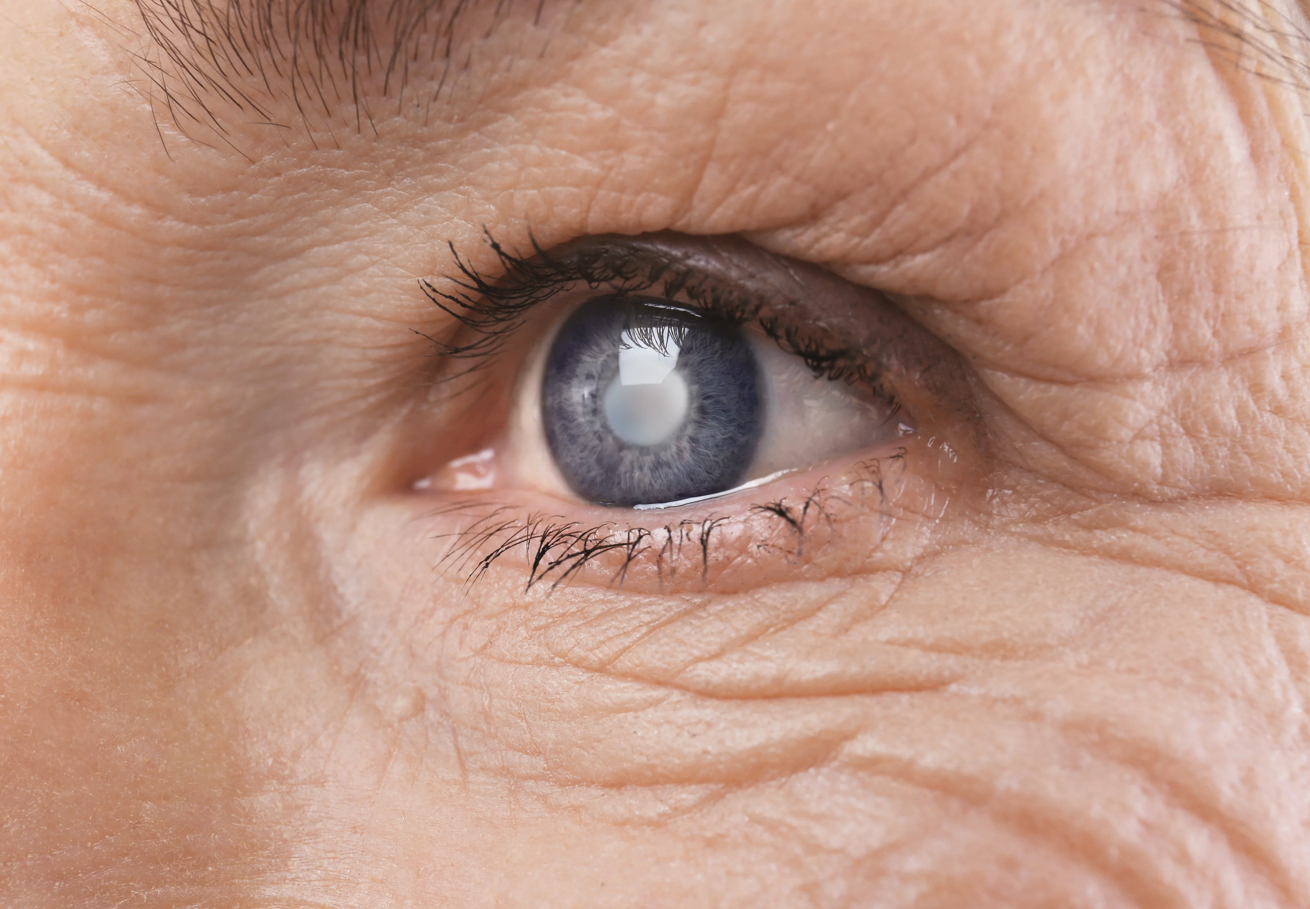 Αναισθησία